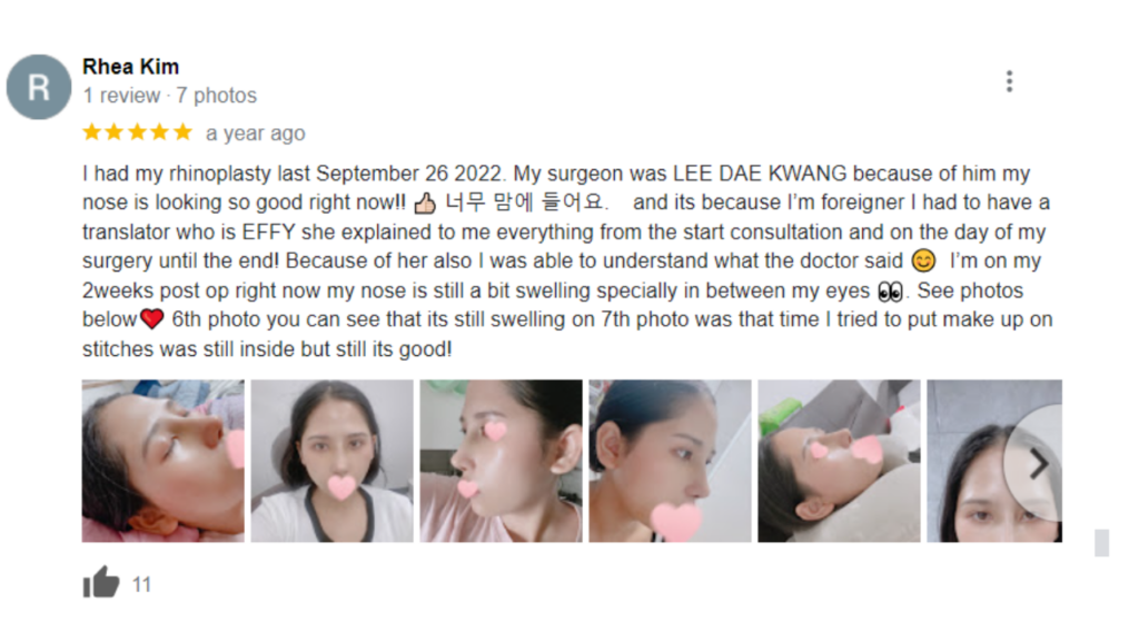 A Positive Review About Rhinoplasty At NANA Plastic Surgery